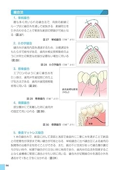 Amazon.co.jp: 歯科臨床まずはここから! 歯周治療: 卒後5年を